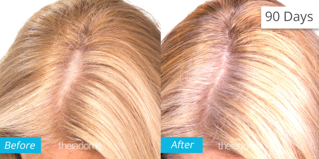 Non Surgical Treatments before and after photo by Elite Dermatology & The Oaks Plastic Surgery in Houston TX