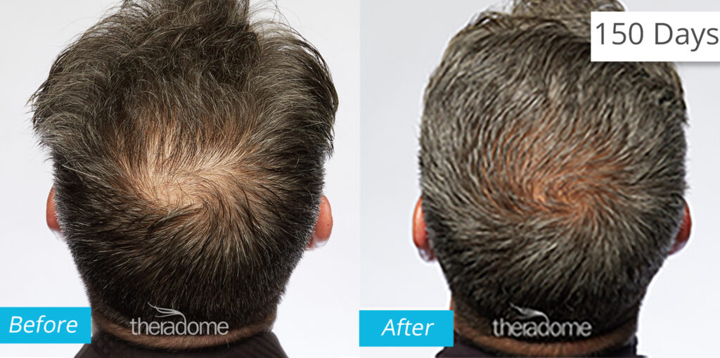 Non Surgical Treatments before and after photo by Elite Dermatology & The Oaks Plastic Surgery in Houston TX