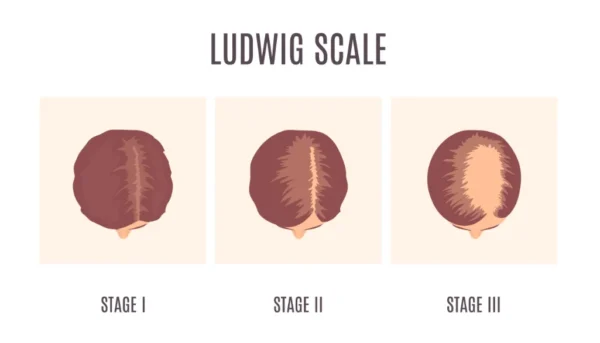 ludwig scale ludwig scale