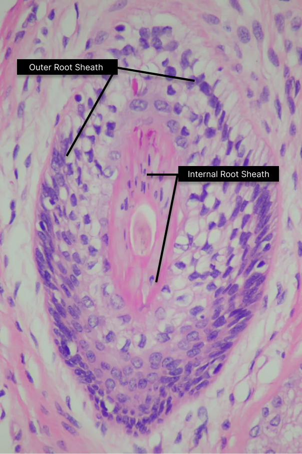 outer inner root sheath and shaft